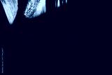 preview cold