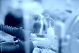 preview cold