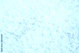 preview cold