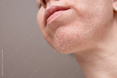 image to crop