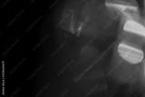 preview bw