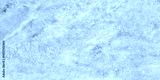 preview cold