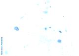 preview cold