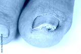 preview cold