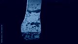 preview cold