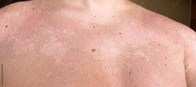 image to crop