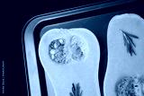 preview cold