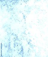 preview cold