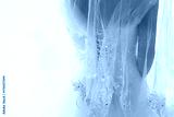 preview cold