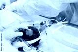 preview cold