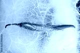 preview cold