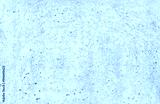 preview cold