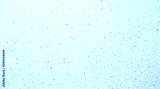 preview cold