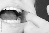 preview bw