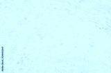 preview cold