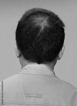 preview bw