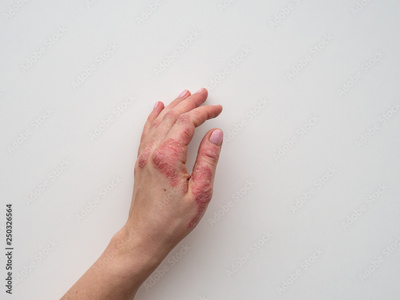 image to crop