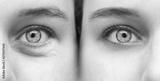 preview bw