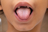 preview original