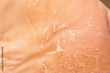preview original