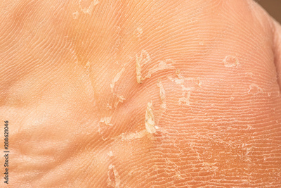 image to crop
