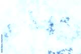 preview cold