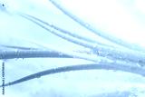 preview cold