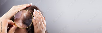 image to crop