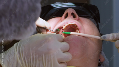 image to crop