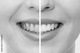 preview bw