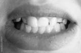preview bw
