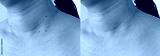 preview cold