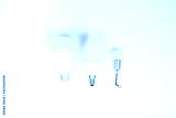 preview cold