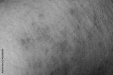 preview bw