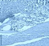 preview cold