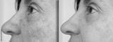 preview bw