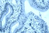 preview cold