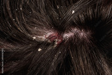 preview original