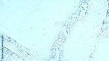 preview cold