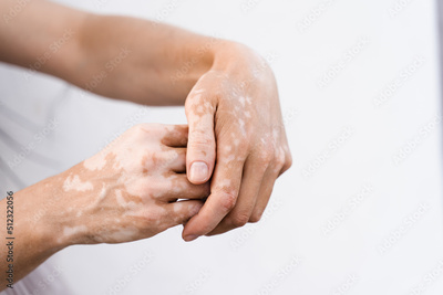 image to crop