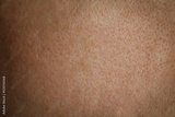preview original