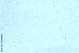preview cold