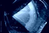 preview cold