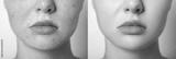 preview bw