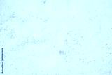 preview cold