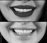 preview bw