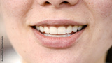 preview original