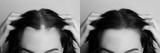preview bw