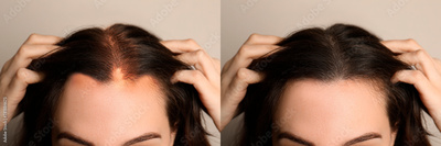 image to crop