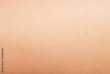 preview original